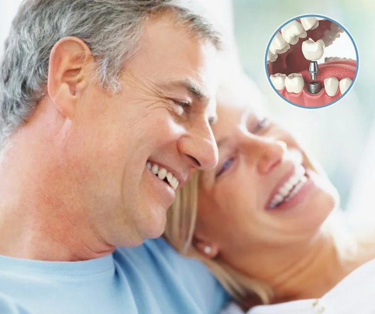 Smiling couple after dental implant treatment
